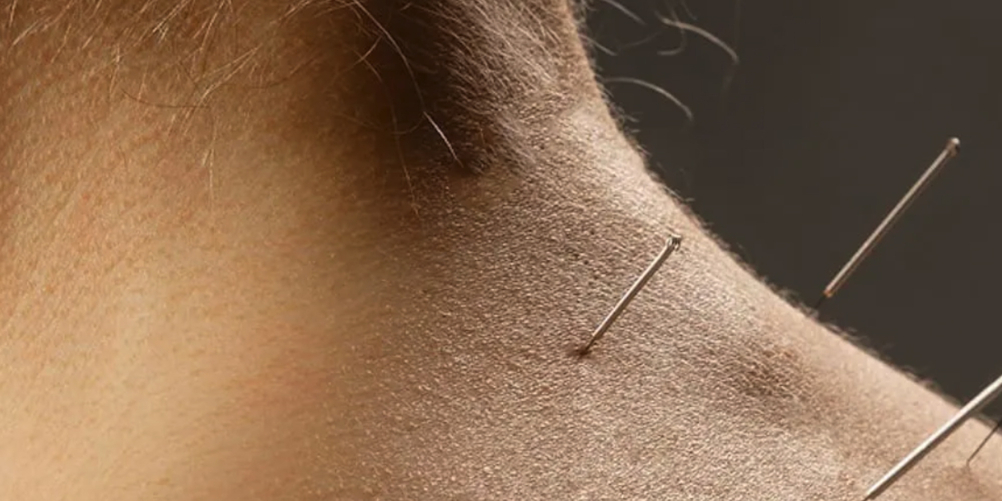 chiche-communication_AcuraPoint